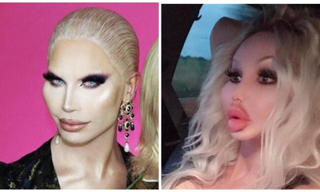 Opfer der plastischen Chirurgie. Quelle: Sreenshot