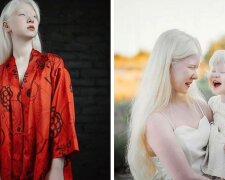 Die Albino-Schwestern wurden im Abstand von 12 Jahren geboren und bekommen mit ihrem fabelhaften Aussehen die Aufmerksamkeit der Modewelt