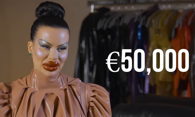 Frau investiert fünfstellige Summe in Lippen. Quelle: Youtube Screenshot