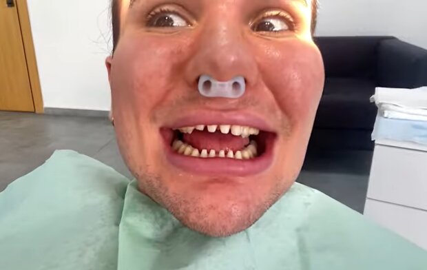 Ein riskantes Verfahren für die Zähne. Quelle: Screenshot YouTube