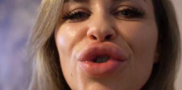 Lippenvergrößerung statt Selbstzweifel. Quelle: Youtube Screenshot