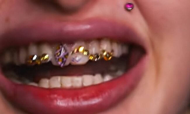 Ungewöhnliche Zähne. Quelle: Youtube Screenshot