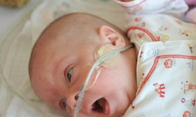 Lebenswunsch: Das kleine Baby konnte trotz den Prognosen der Ärzte überleben