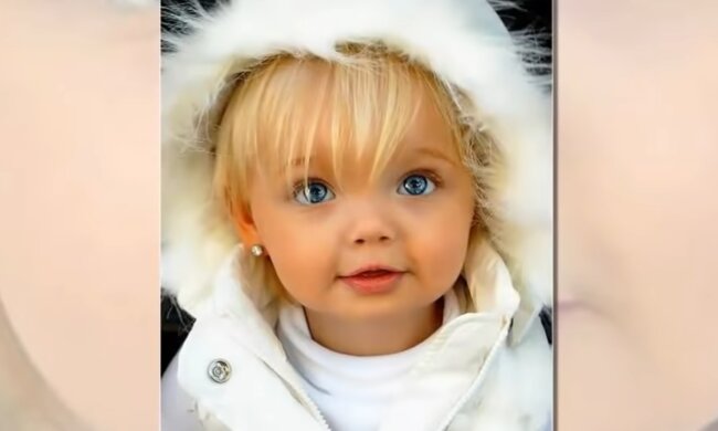 Ein Mädchen wurde mit Puppenaussehen geboren: wie es Jahre später aussieht