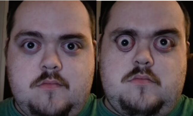 Ein Mann hat die Fähigkeit, mit den Augen unglaublich stark zu blinzeln. Quelle: Screenshot YouTube