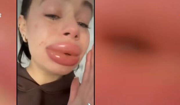 Hyaluronsäure statt Selbstliebe? Quelle: Youtube Screenshot