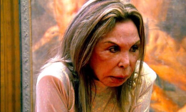 Verehrerin der plastischen Chirurgie: Wie Elsa Patton lebte