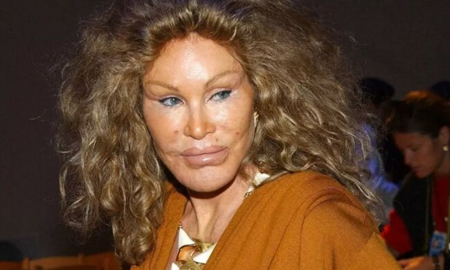 Wie eine Frau-Katze Jocelyn Wildenstein aussah, bevor sie ein Opfer von Plastik wurde