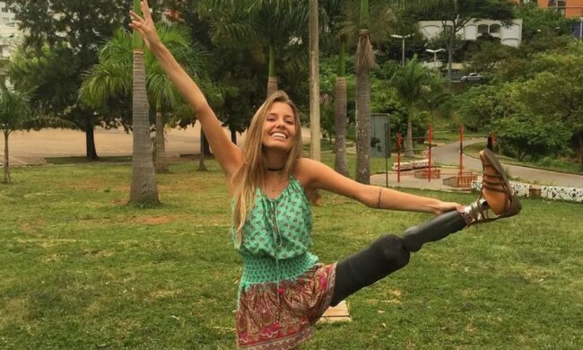 Das brasilianische Modell hat ihr Bein verloren, zeigt aber, dass sich sein Leben keineswegs verändert hat