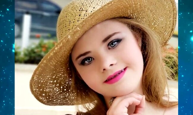 Eine besondere junge Frau wurde trotz der Umstände das Gesicht einer Kosmetikmarke