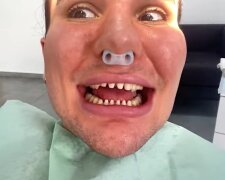 Ein riskantes Verfahren für die Zähne. Quelle: Screenshot YouTube