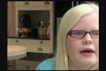 Albino-Mädchen. Quelle: Youtube Screenshot