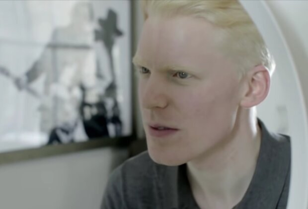 Albinismus ist eine seltene natürliche Anomalie. Quelle: Screenshot YouTube