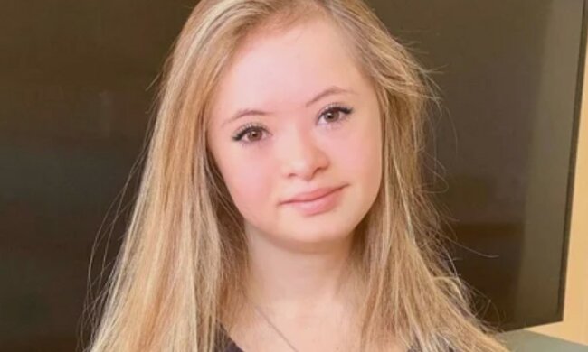 Kennedy Garcia: Lebensgeschichte eines 16-jährigen Models mit einer besonderen Diagnose