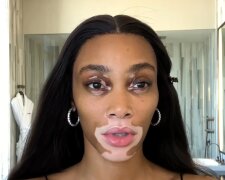 Winnie Harlow. Quelle: YouTube Screenshot