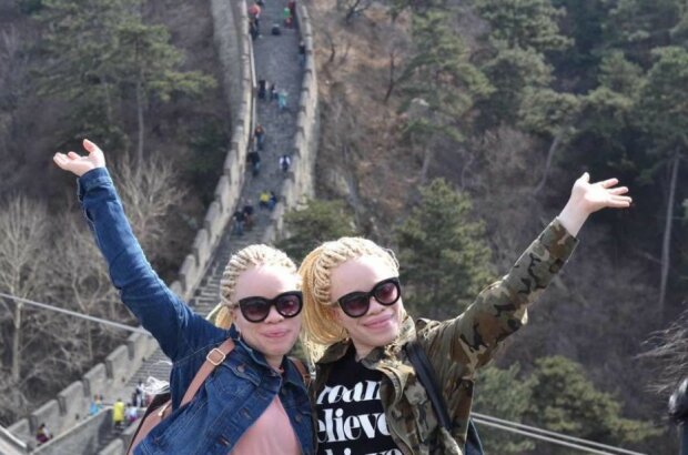 Ungewöhnliche Albino-Zwillinge fanden dank sozialen Medien ihren Platz im Leben