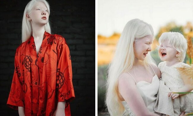 Die Albino-Schwestern wurden im Abstand von 12 Jahren geboren und bekommen mit ihrem fabelhaften Aussehen die Aufmerksamkeit der Modewelt