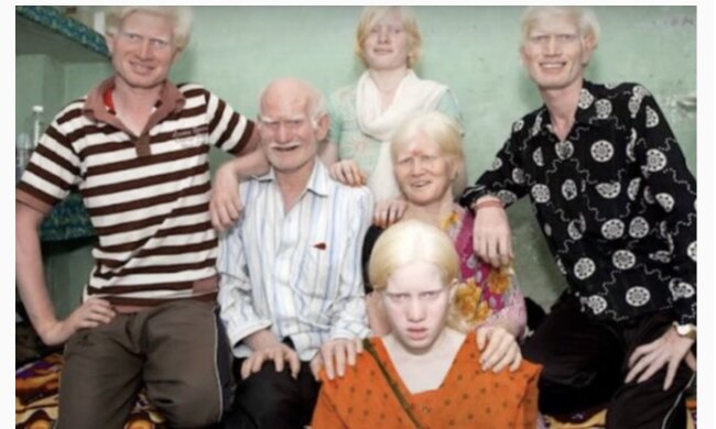 Albino-Familie. Quelle: Screenshot YouTube