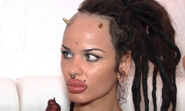 “Modifikationen sind vorbei”: Das Mädchen hat sich dank einer neuen Beziehung verändert