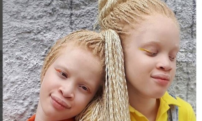 Albino-Zwillinge Lara und Mara. Quelle: Screenshot Youtube