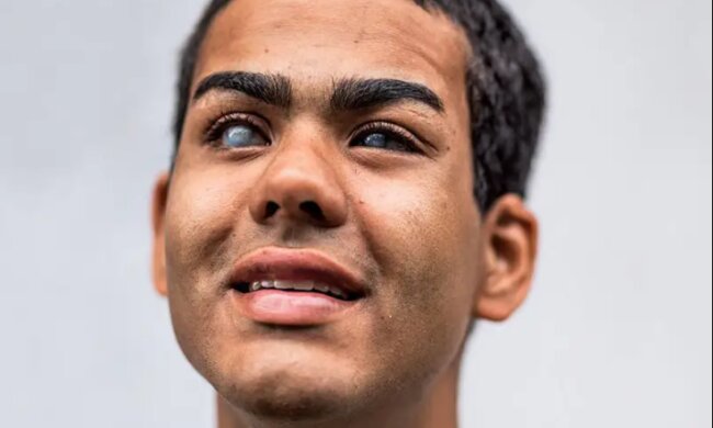 Ein Surfer, der nicht sehen kann, bezähmt die Wellen, indem er "dem Ozean zuhört"