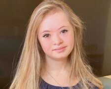 Kennedy Garcia: Lebensgeschichte eines 16-jährigen Models mit einer besonderen Diagnose