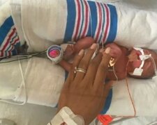 Nachts bedeckte die Mutter ihr frühgeborenes Kind mit einem Handschuh und rettete es