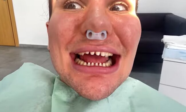 Ein riskantes Verfahren für die Zähne. Quelle: Screenshot YouTube