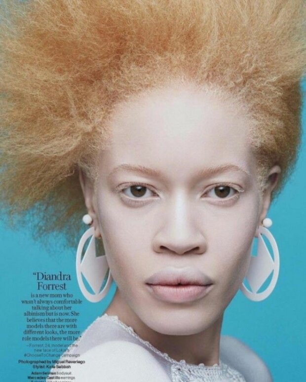 Wie Albino-Frau Diandra Forrest ein gefragtes Modell wurde
