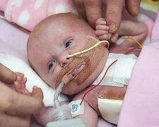 Britische Ärzte retteten ein Baby, das mit dem Herz außer dem Brustkorb geboren wurde