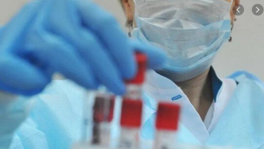 “Das ist sehr schnell”: in Singapur wurde der schnellste Test für Coronavirus erstellt