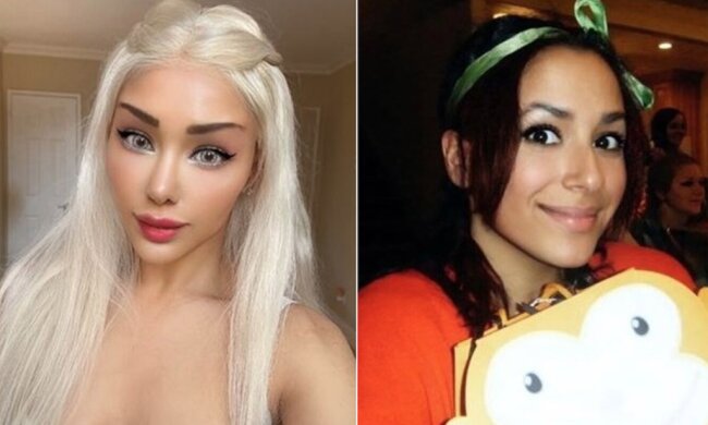 "Leben zurückgewinnen": ein Barbie-Mädchen beschließt, wieder gewönlich auszusehen