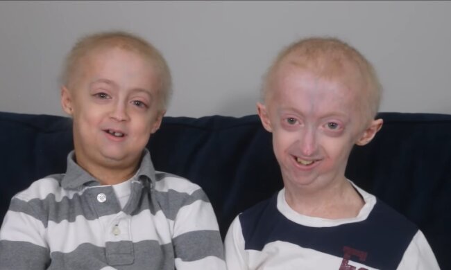 Der Kampf und die Träume zweier Brüder mit Progerie. Quelle: Youtube Screenshot