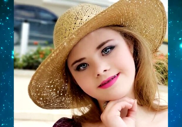Eine besondere junge Frau wurde trotz der Umstände das Gesicht einer Kosmetikmarke