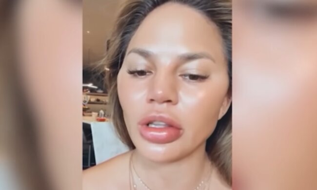 Wenn Schönheit zur Geldfrage wird. Quelle: Youtube Screenshot