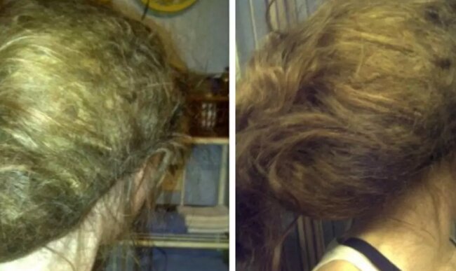 Nach einem Jahr verwandelten sich lange Haare in einen gewichtigen "Stein": Der Meister brauchte sieben Stunden, machte aber eine wunderschöne Frisur