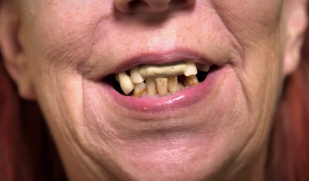 Die Trennung von der Zahnhygiene. Quelle: Youtube Screenshot