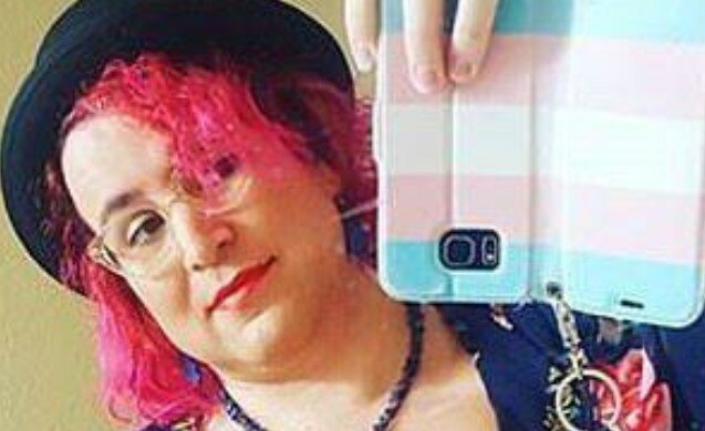 Ein Mann vergrößerte seine Brust auf Größe 5, um weiblicher zu werden