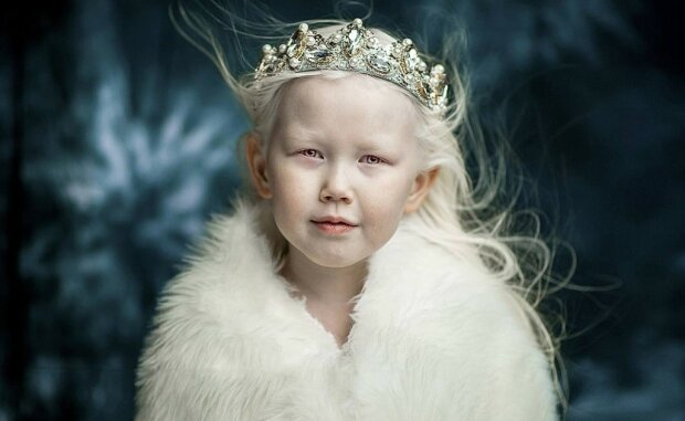 Das echte Schneewittchen: Das Albino-Mädchen bezaubert jeden mit ihrer natürlichen Schönheit