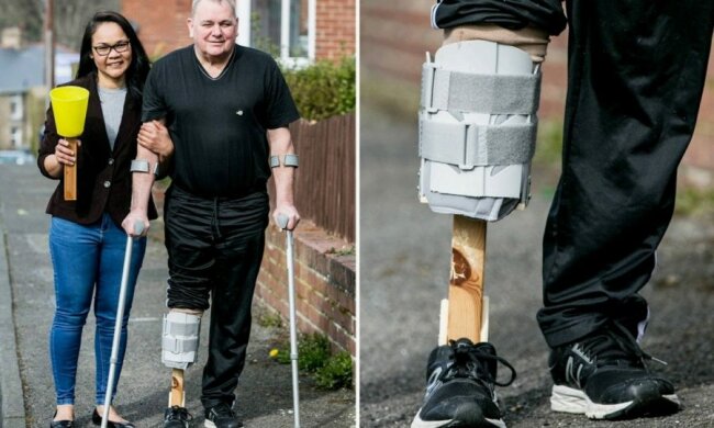 Eine liebende Frau: Wie eine Frau Prothese für ihren Ehemann selbst herstellte