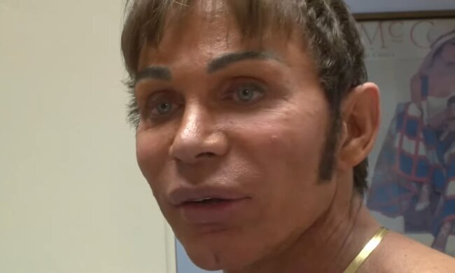 Ein 50-Jähriger und seine radikalen Schönheitsveränderungen. Quelle: Youtube Screenshot