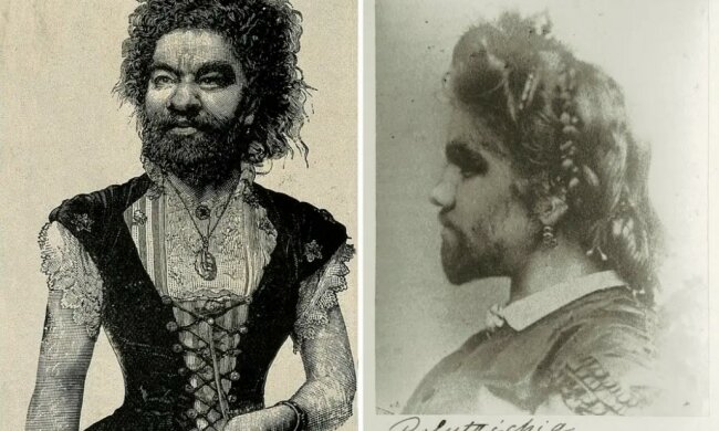 Wie war im 19. Jahrhundert das Leben der bärtigen Frau Hulia