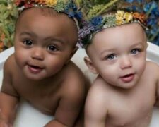 Kaum zu glauben: seltene Zwillinge beeindruckten alle mit ihrem Aussehen