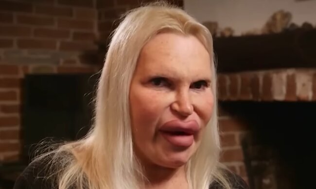 Schönheitschirurgie als Selbstliebe. Quelle: Youtube Screenshot