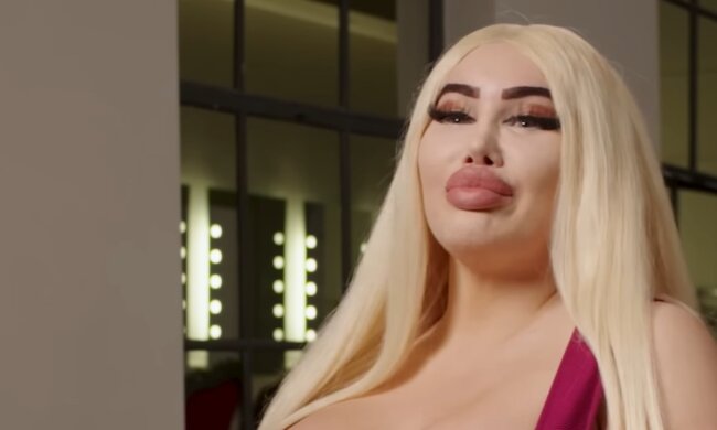 Die Botox-Liebhaberin. Quelle: Youtube Screenshot