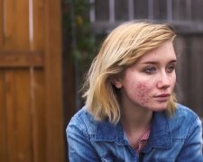 Pickel? Egal!.  Quelle: Youtube Screenshot