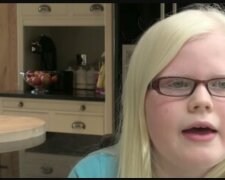 Albino-Mädchen. Quelle: Youtube Screenshot