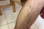 Bein-Epilation. Quelle: Youtube Screenshot