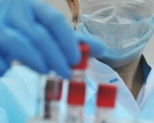 “Das ist sehr schnell”: in Singapur wurde der schnellste Test für Coronavirus erstellt