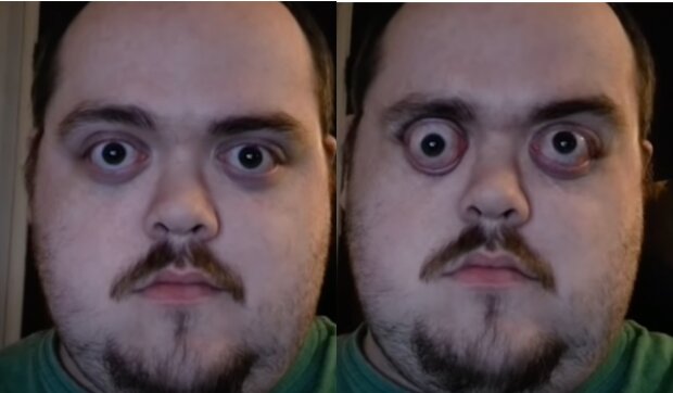 Ein Mann hat die Fähigkeit, mit den Augen unglaublich stark zu blinzeln. Quelle: Screenshot YouTube